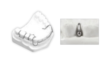 "Ball Clasps 1 0mm  040"""