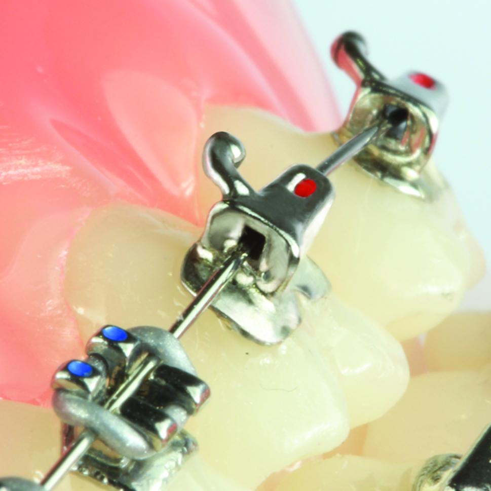 Evolve 2nd molar Roth tube 022 LR (UN)